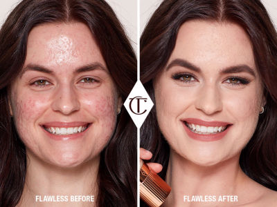 A before-and-after of fair skin model with acne-covered skin in one shot and a flawless base with no acne in the other. 