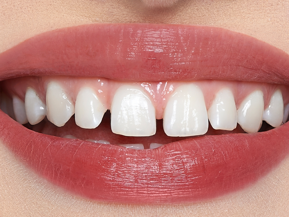 Lips close-up of a light-tone model wearing a soft, nude-brown lip tint.