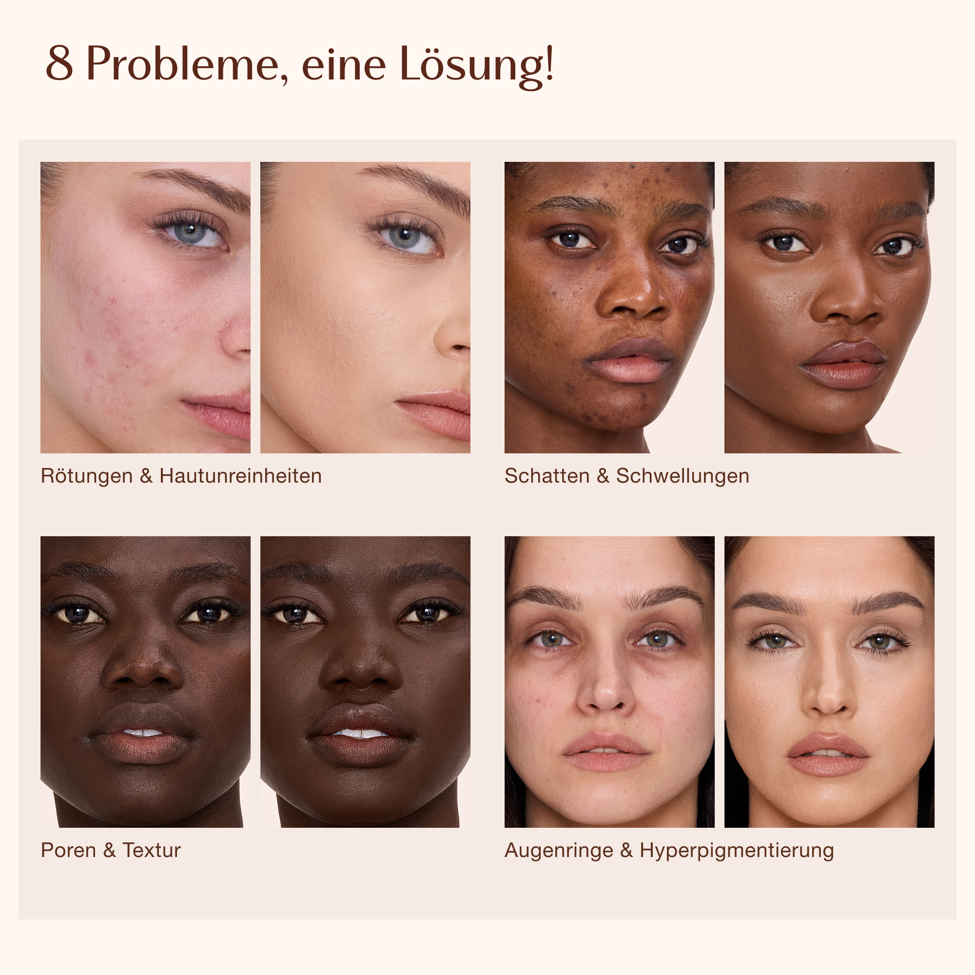 Grafik mit dem Titel „8 Probleme, 1 Lösung!“ mit Beschriftungen für Hautprobleme: Schatten und Schwellungen, Poren und Textur, Augenringe und Hyperpigmentierung.