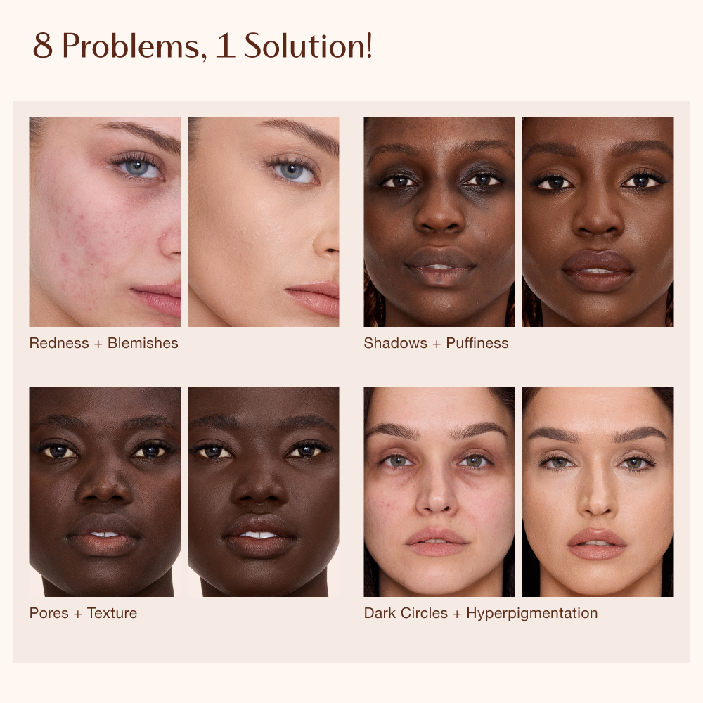 Graphic titled '8 Problems, 1 Solution!' showing text labels for skin concerns: Shadows and Puffiness, Pores and Texture, Dark Circles and Hyperpigmentation.