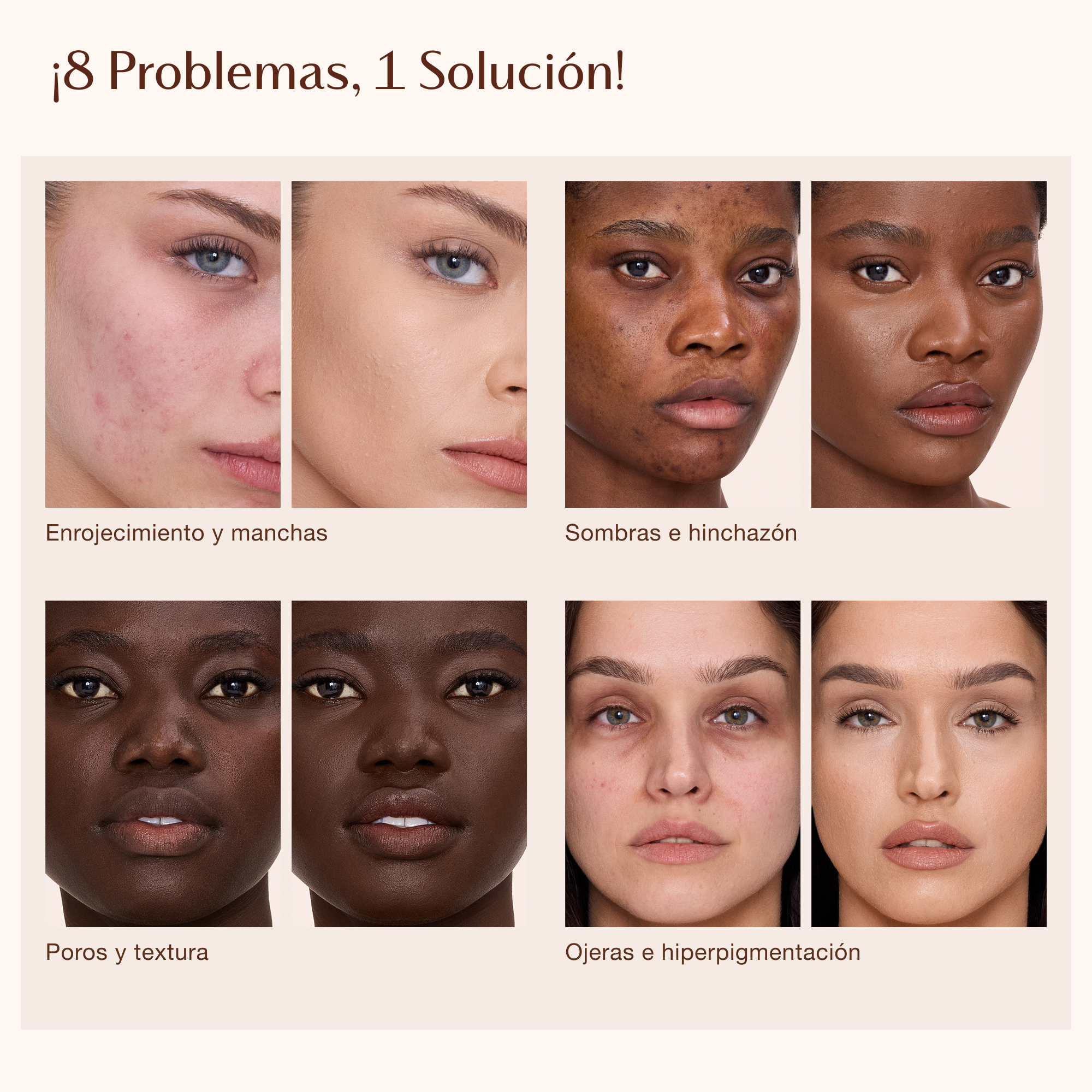 Gráfico titulado "8 problemas, 1 solución" con etiquetas de texto para problemas de la piel: sombras e hinchazón, poros y textura, ojeras e hiperpigmentación.