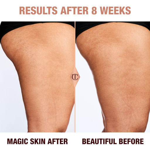 Results of Magic Body Cream after 8 weeks on a fair skin model