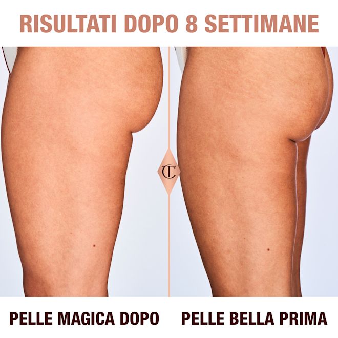 Risultati di Magic Body Cream dopo 8 settimane su una modella di carnagione media Risultati di Magic Body Cream dopo 8 settimane su una modella di carnagione media