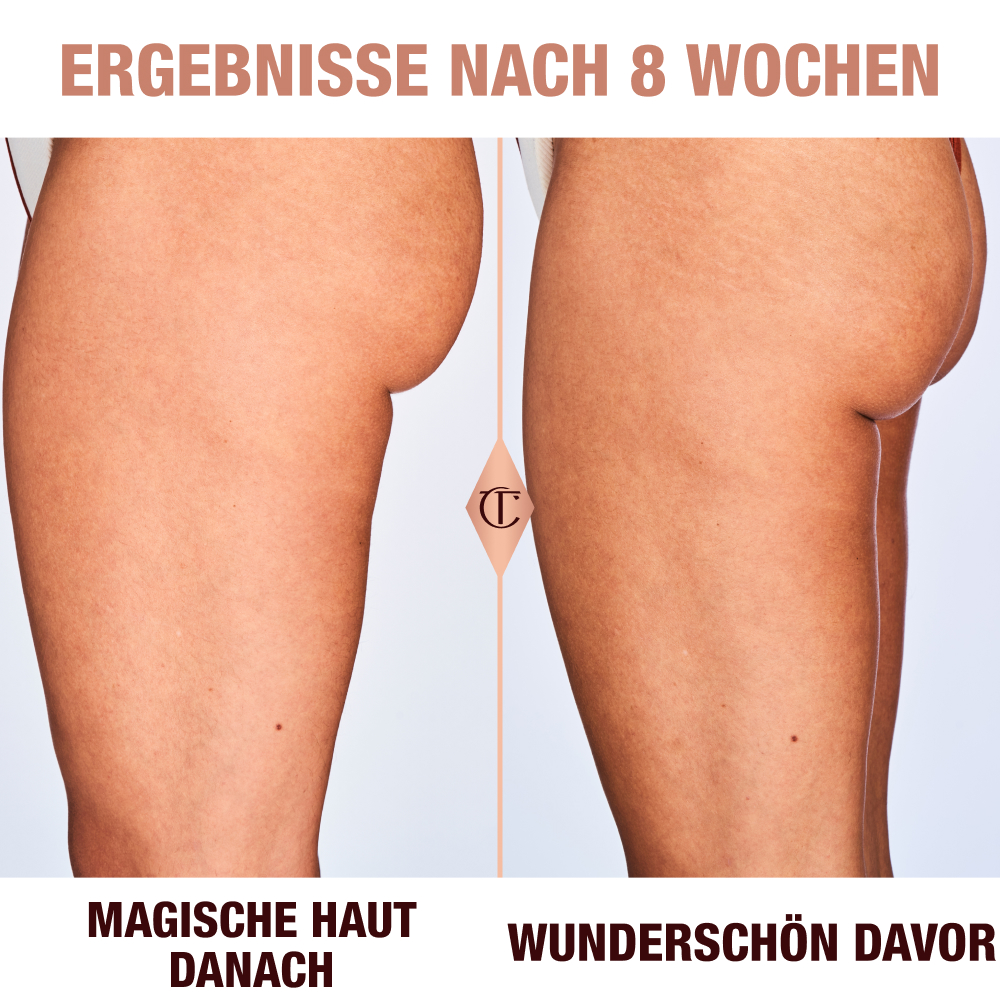 Ergebnisse der Magic Body Cream nach 8 Wochen an einem Model mit mittlerem Hautton