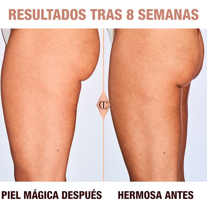 Resultados de la Magic Body Cream después de 8 semanas en una modelo con tono de piel medio Resultados de la Magic Body Cream después de 8 semanas en una modelo con tono de piel medio