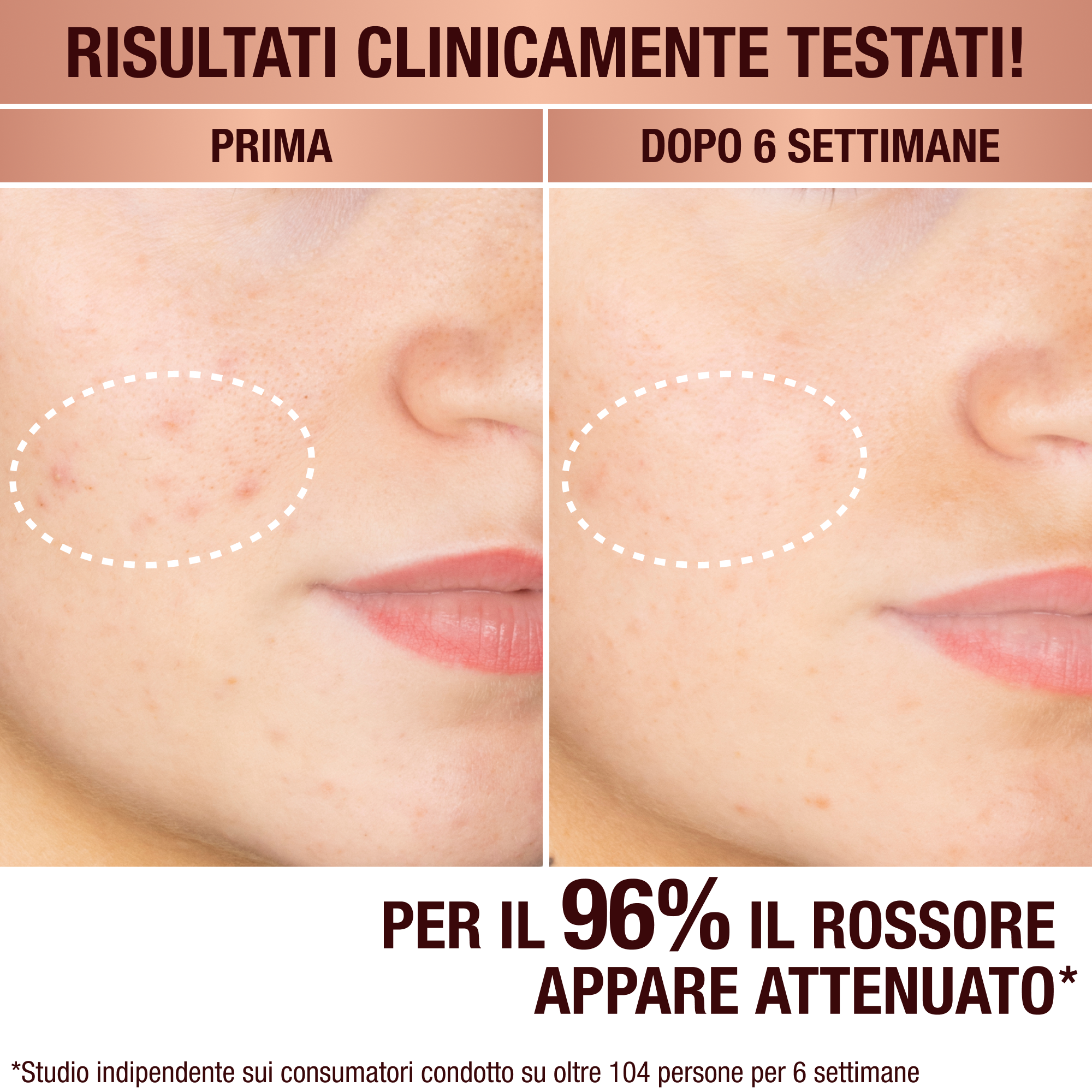 Il siero per macchie scure di Charlotte