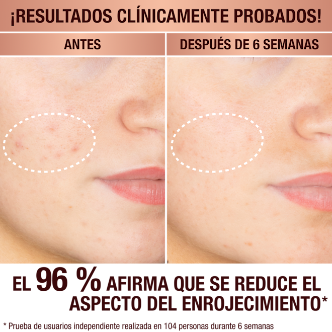 Charlotte's Dark Spot Serum Charlotte's Dark Spot Serum