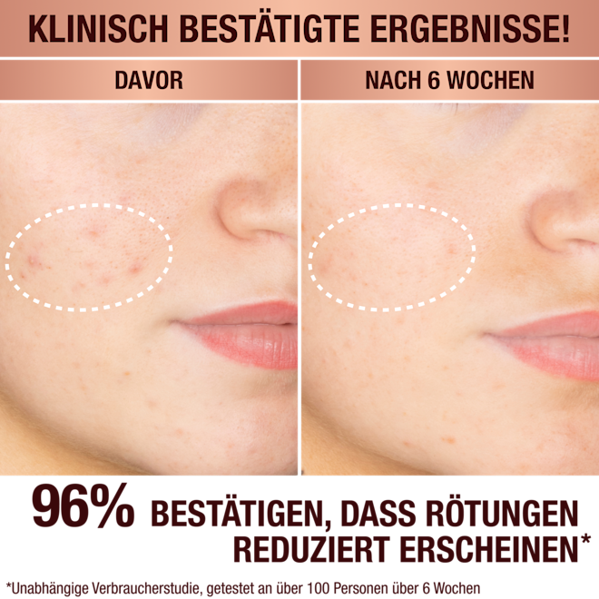 Charlotte's Dark Spot Serum Charlotte's Dark Spot Serum