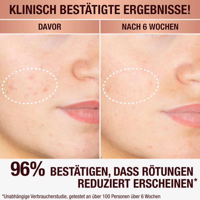 Charlotte's Dark Spot Serum Charlotte's Dark Spot Serum