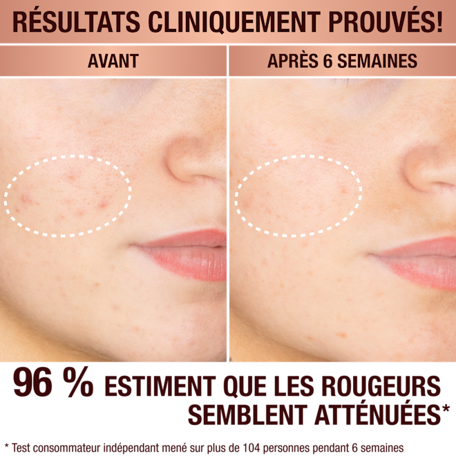 Sérum anti-taches brunes de Charlotte Sérum anti-taches brunes de Charlotte