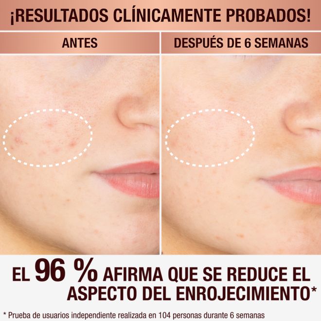 Charlotte's Dark Spot Serum Charlotte's Dark Spot Serum