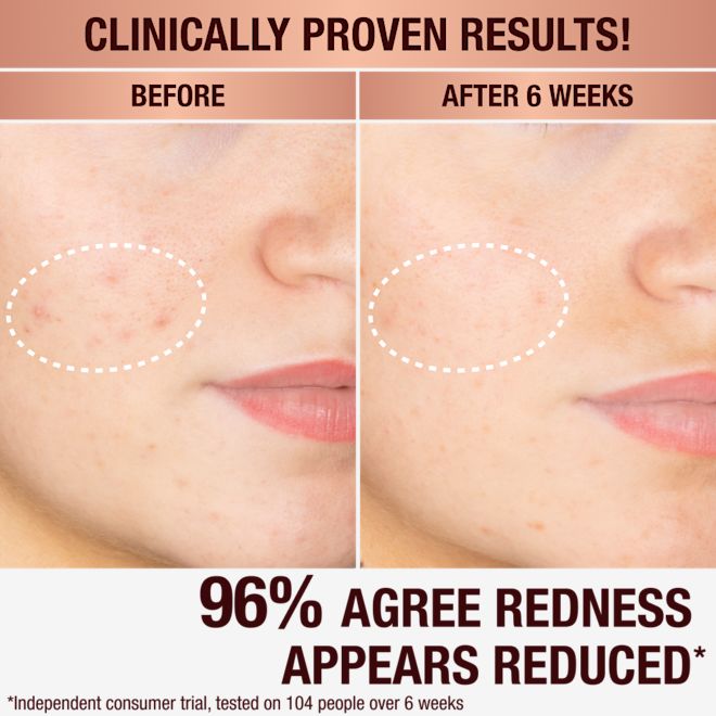 Charlottes Dark Spot Serum Charlottes Dark Spot Serum