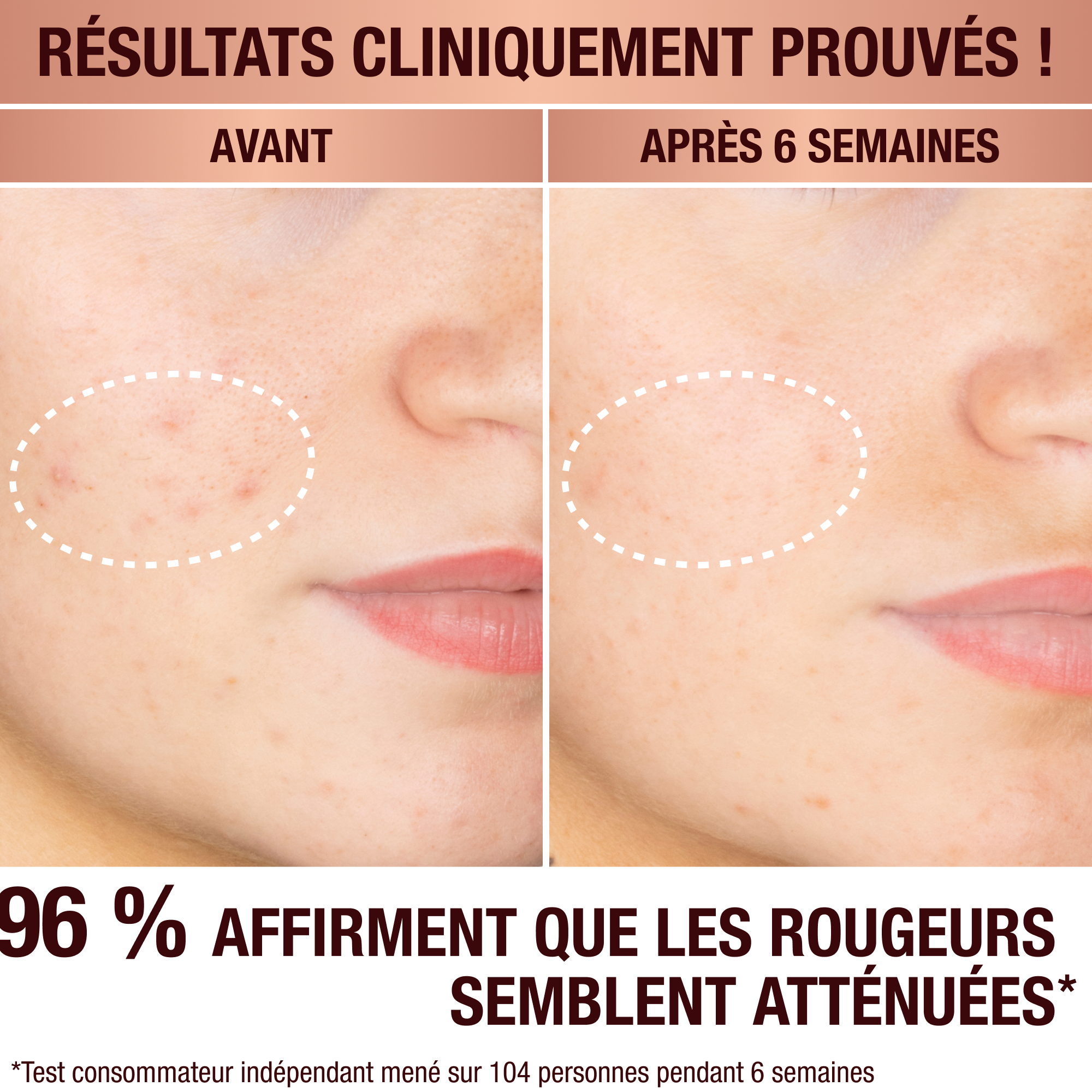 Sérum anti-taches de Charlotte