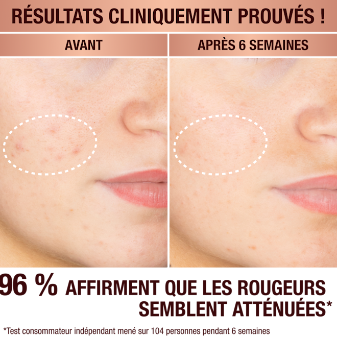 Sérum anti-taches de Charlotte Sérum anti-taches de Charlotte