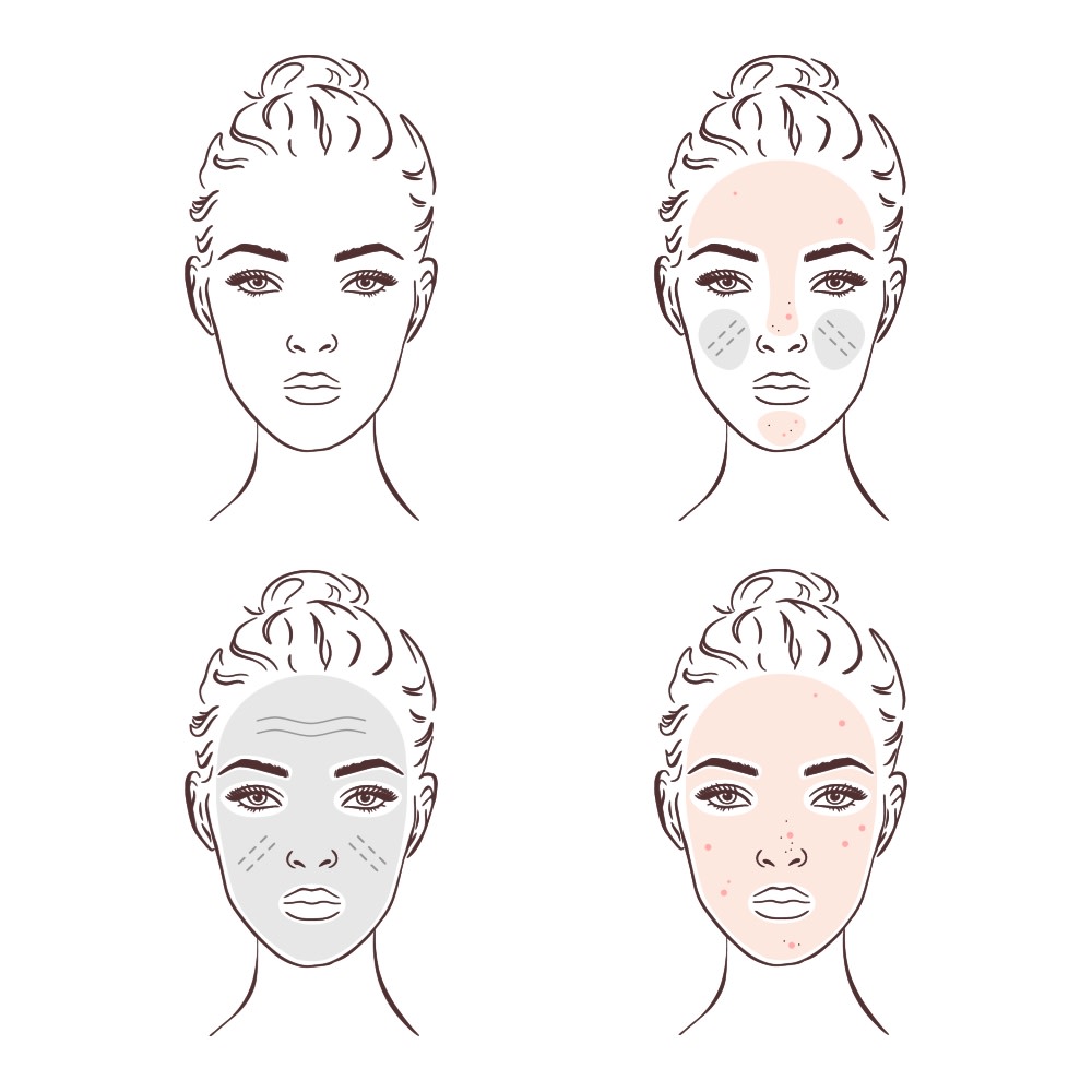 4 illustrierte Gesichter mit unterschiedlichen Hautbeschaffenheiten, die normale, Mischhaut, trockene und fettige Haut darstellen