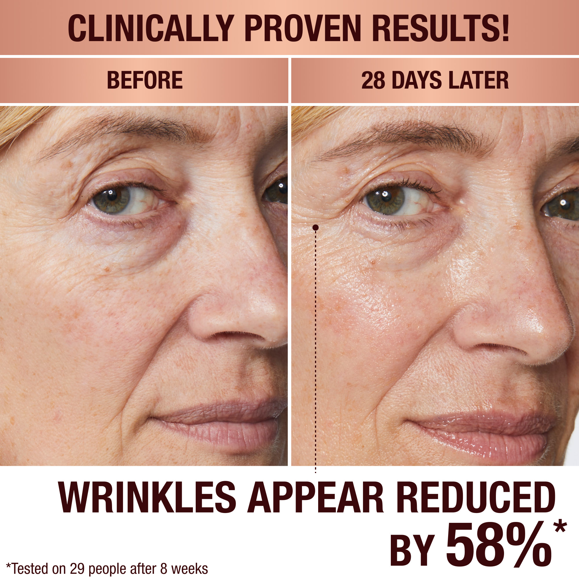 Before and after image showing anti-ageing results of mature skin model using Magic Cream for 28 days