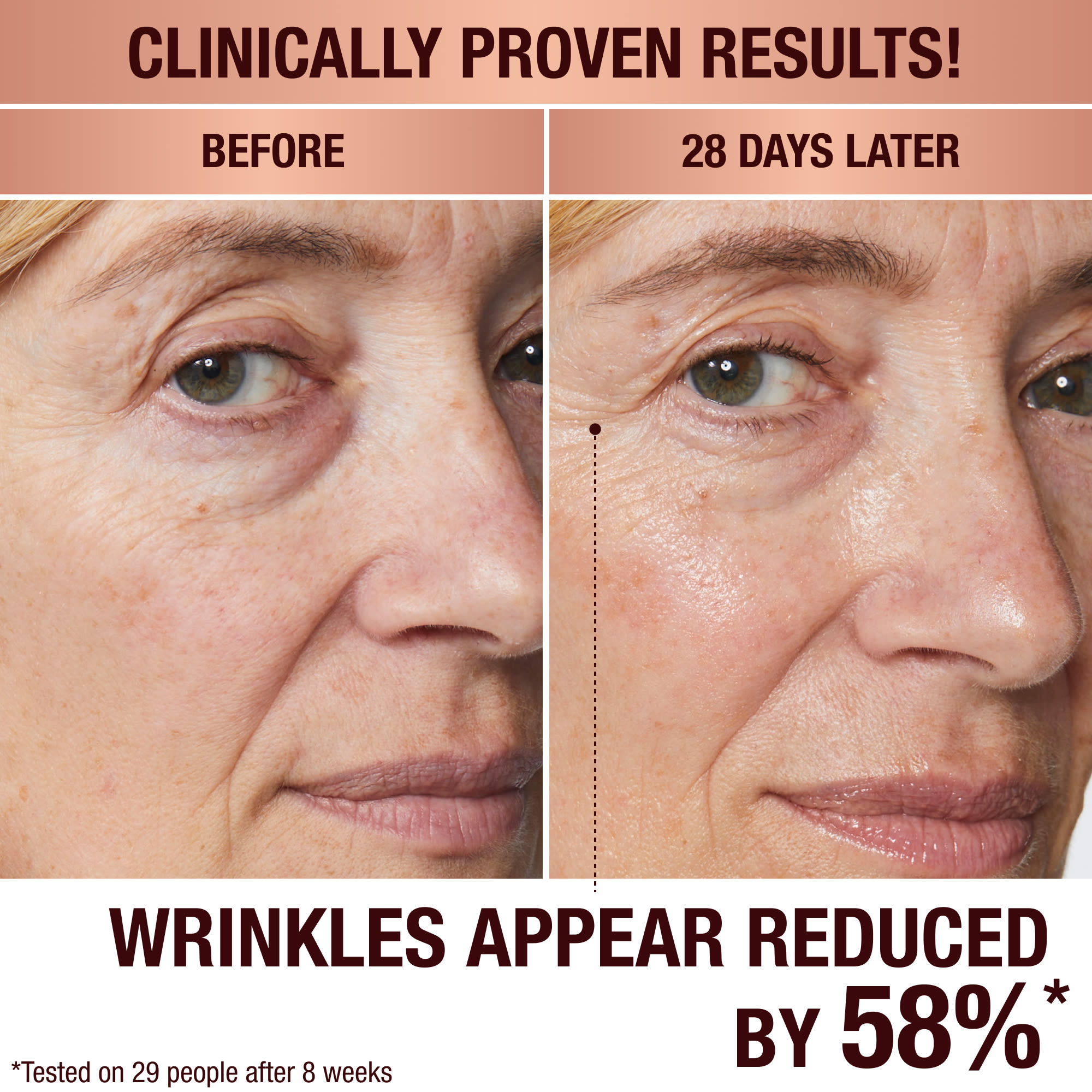 Before and after image showing anti-ageing results of mature skin model using Magic Cream for 28 days