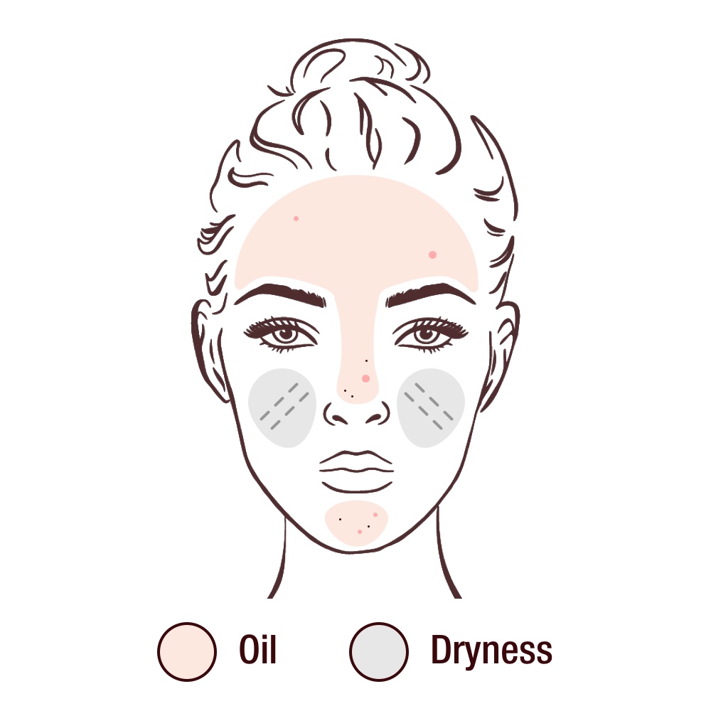 SKIN TYPE DIAGRAM - COMBINATION