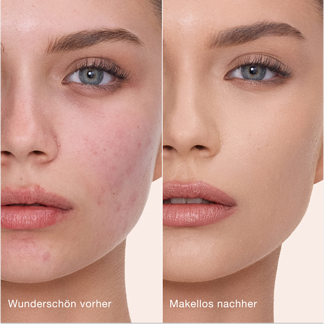 Airbrush Flawless Concealer − 5 Medium, vorher und nachher Airbrush Flawless Concealer − 5 Medium, vorher und nachher