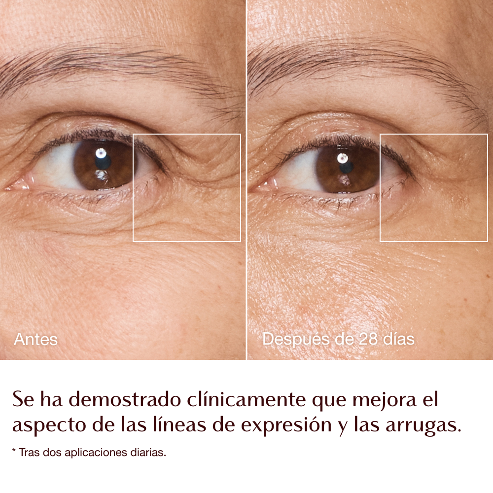 Infografía del antes y el después de la Magic Cream: líneas de expresión y arrugas - modelo Sarah 