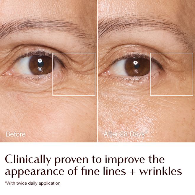 Magic Cream - before and after fine lines and wrinkles infographic - model Sarah Magic Cream - before and after fine lines and wrinkles infographic - model Sarah