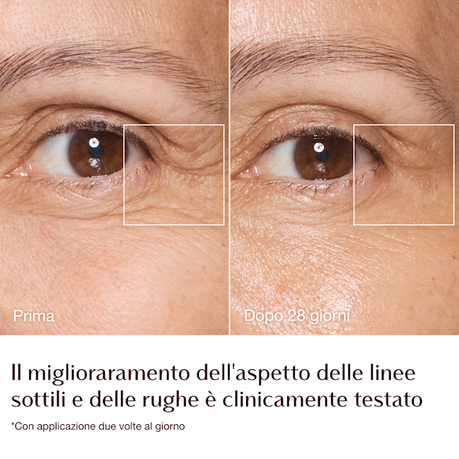Magic Cream - infografica prima e dopo linee sottili e rughe - modella Sarah Magic Cream - infografica prima e dopo linee sottili e rughe - modella Sarah