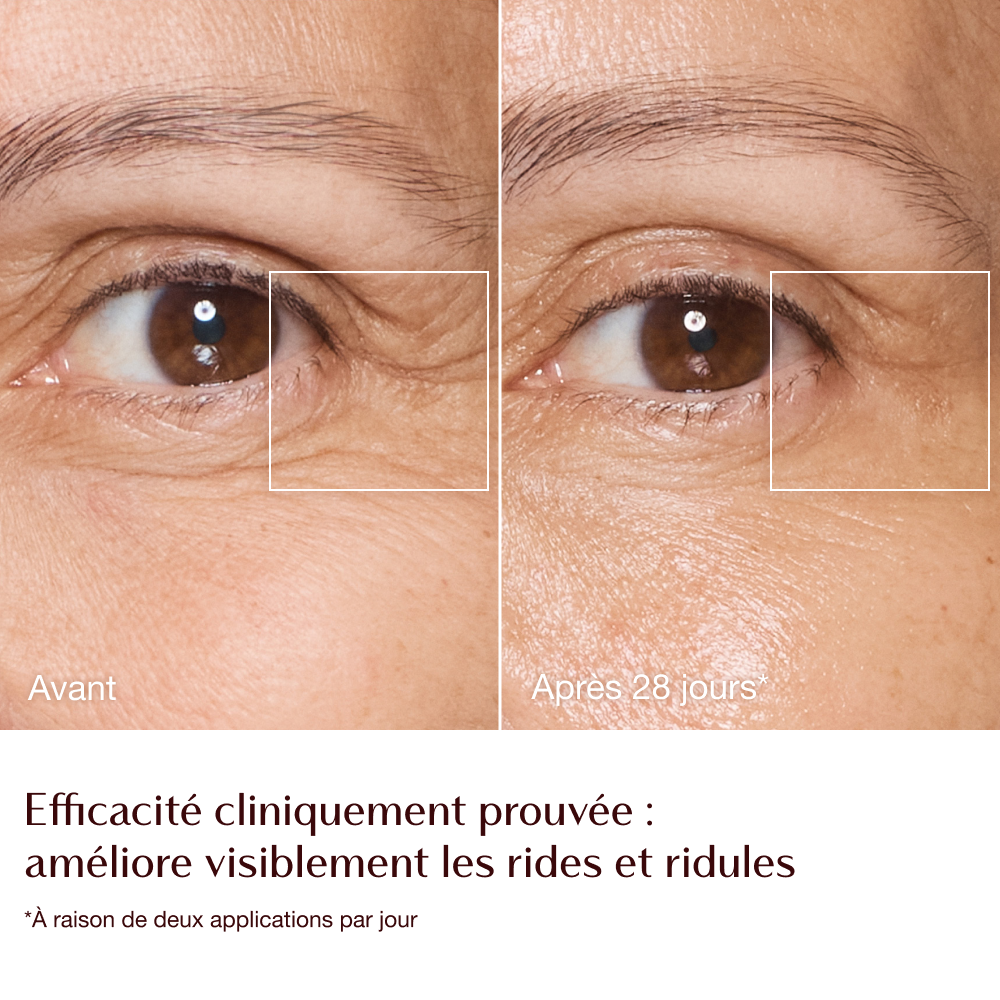 Magic Cream - infographie rides et ridules avant/après - mannequin Sarah 