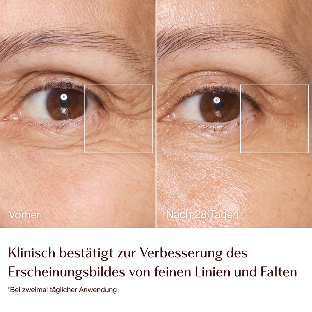 Magic Cream – Vorher-Nachher-Bilder von feinen Linien und Falten − Model Sarah 