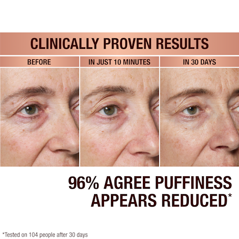 How To Reduce Eye Bags with Eye Patches and Skincare