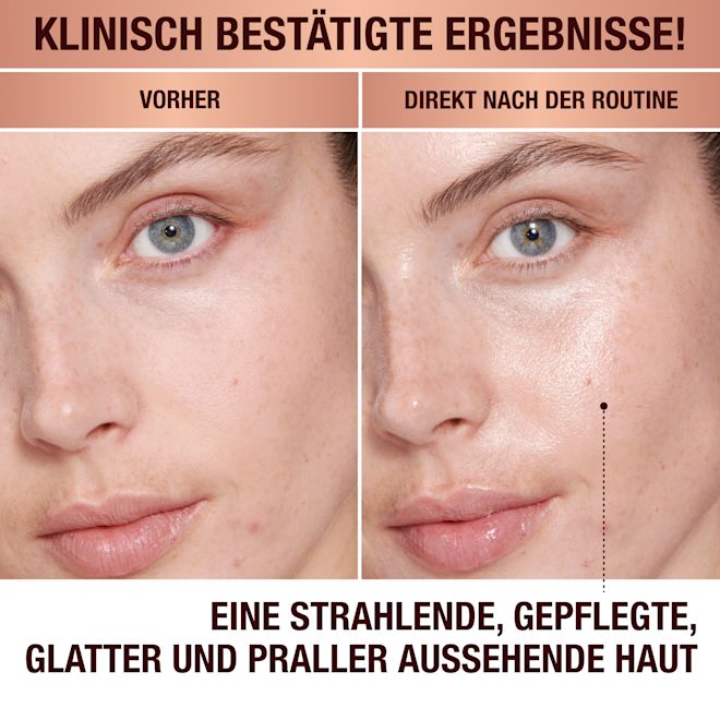 Magic Cream – Vorher und nachher Magic Cream – Vorher und nachher