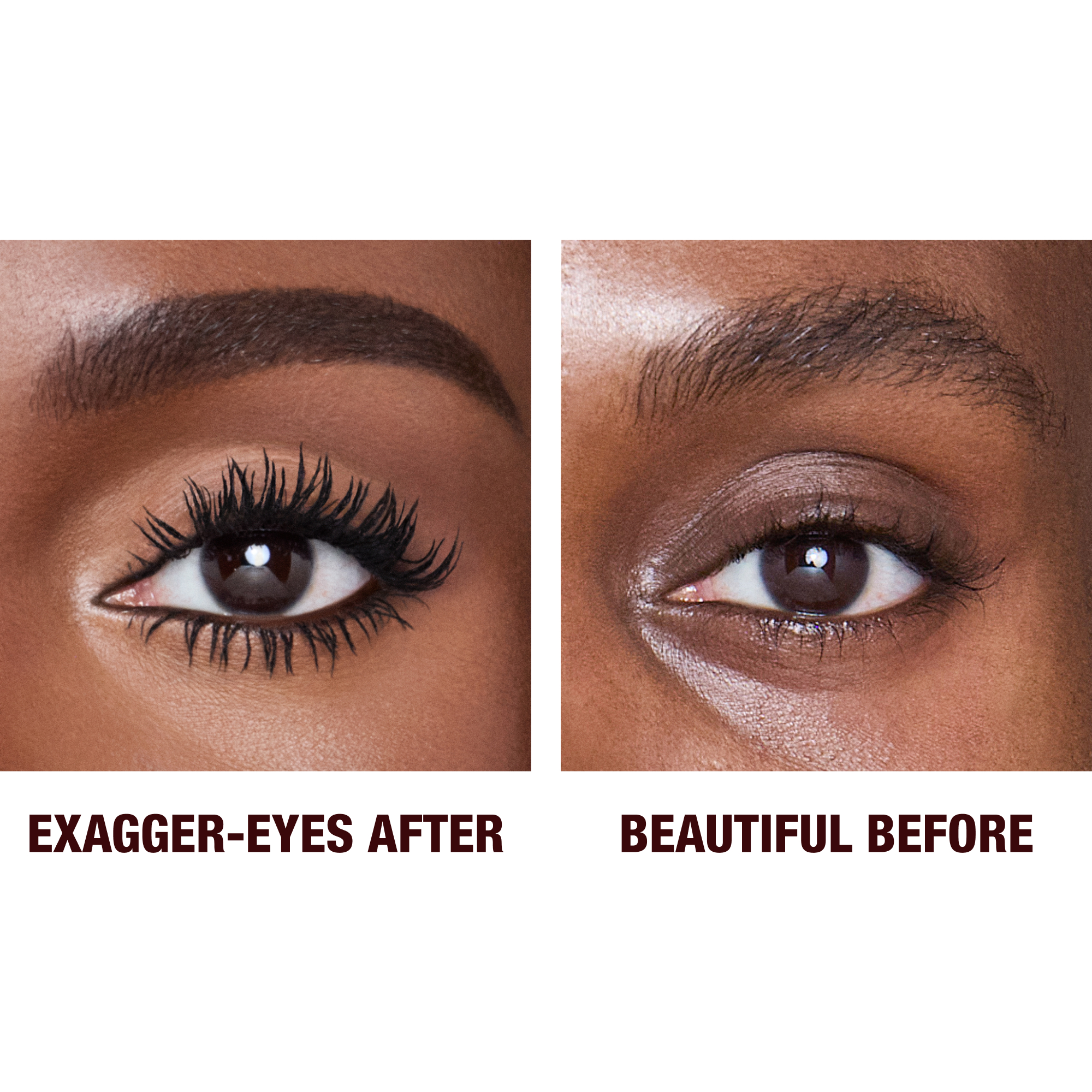 Exagger-Eyes before and after