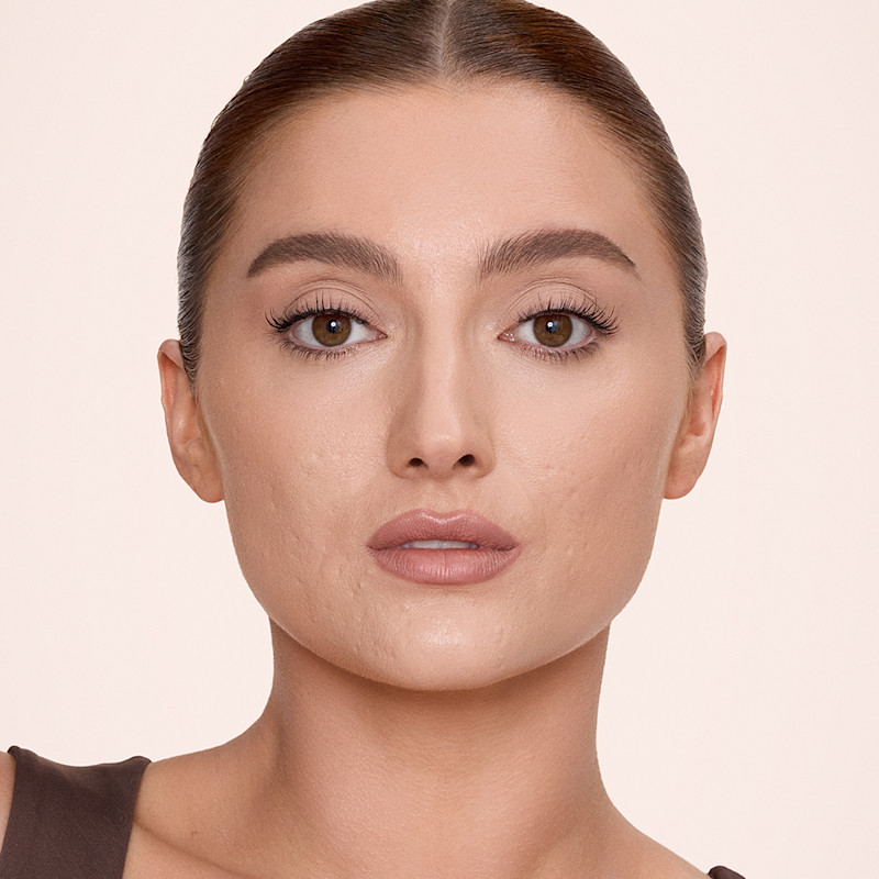 Model wearing foundation and concealer for acne-prone skin