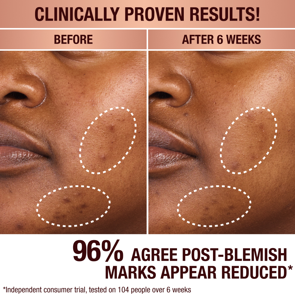 Charlottes Dark Spot Serum