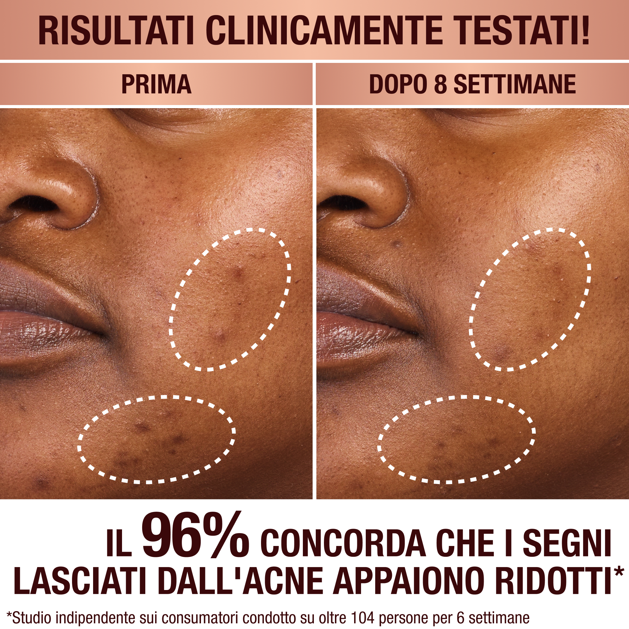 Il siero per macchie scure di Charlotte