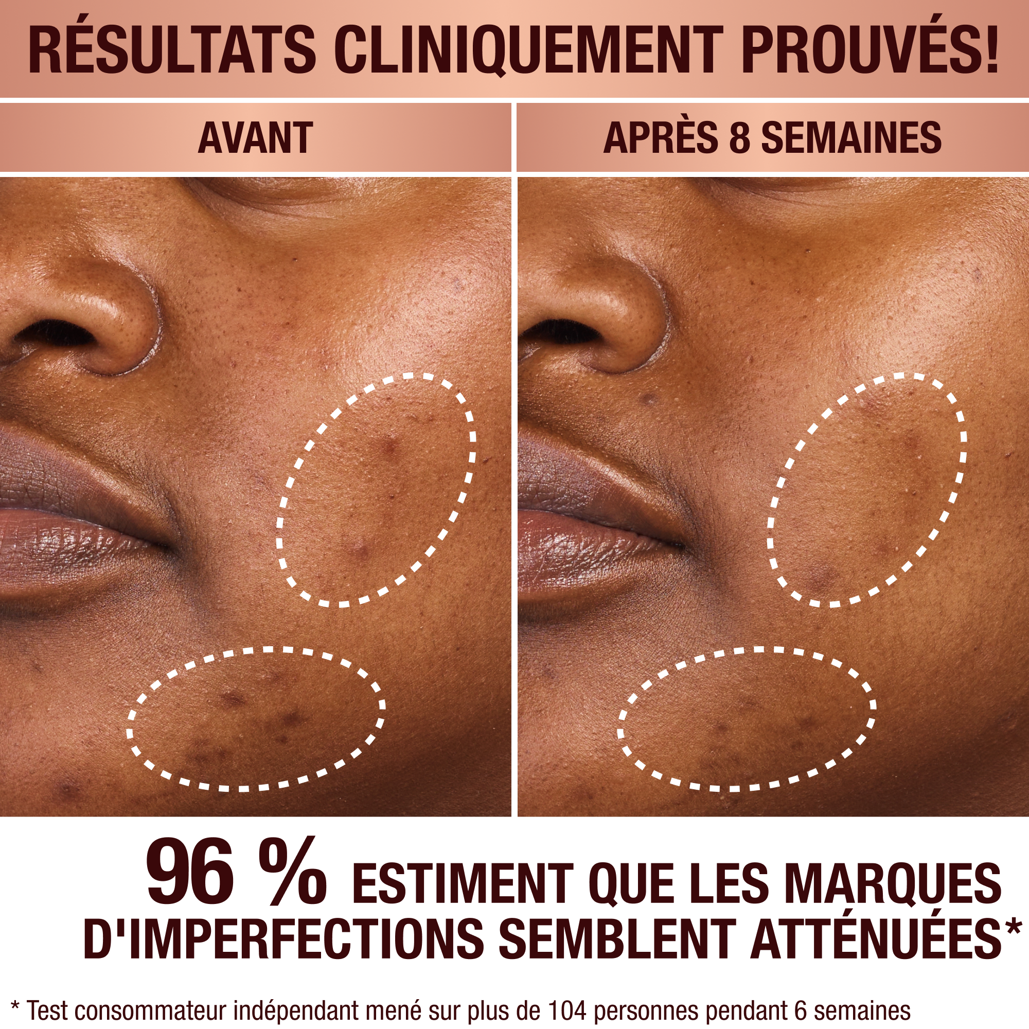 Sérum anti-taches brunes de Charlotte