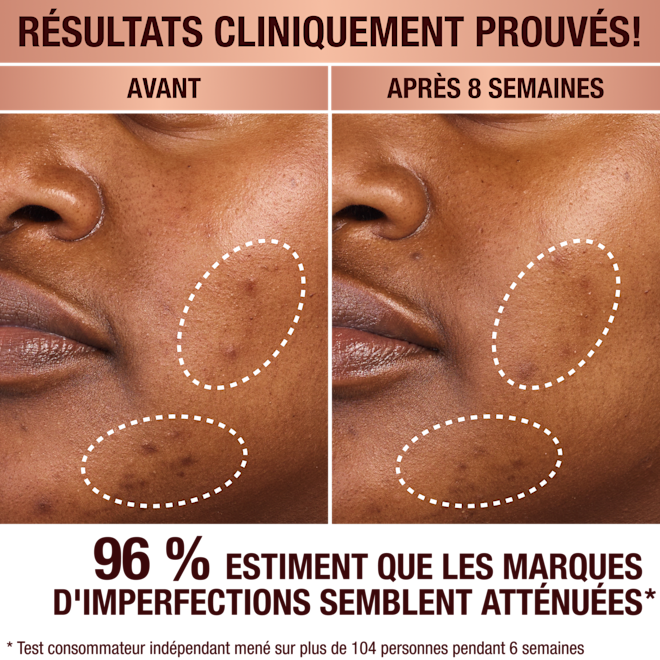 Sérum anti-taches brunes de Charlotte Sérum anti-taches brunes de Charlotte