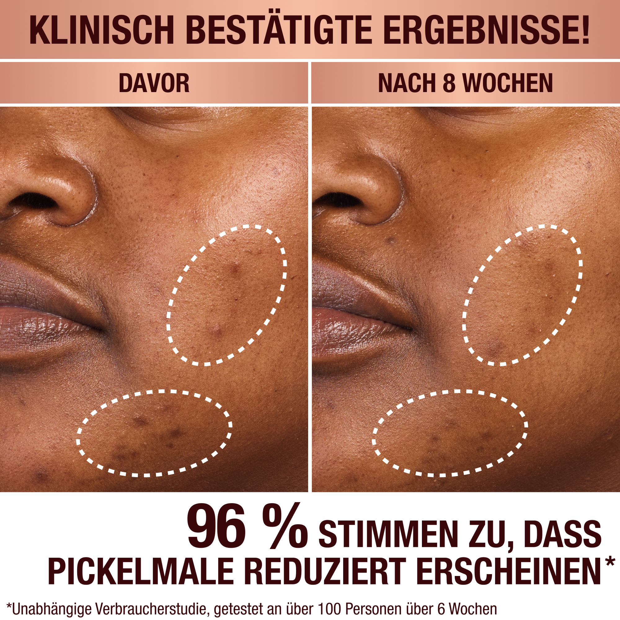 Charlotte's Dark Spot Serum