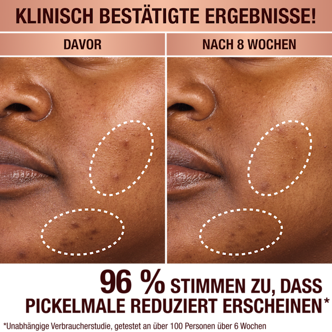 Charlotte's Dark Spot Serum Charlotte's Dark Spot Serum