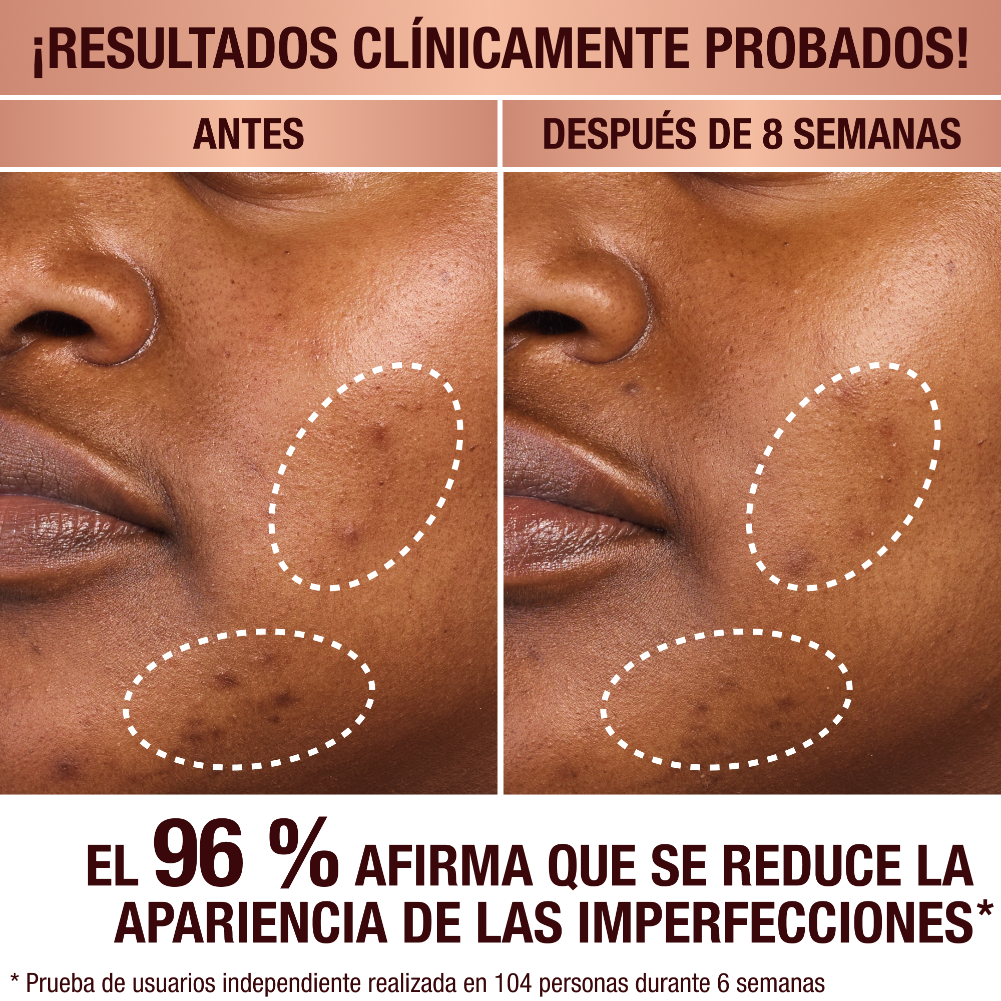 Charlotte's Dark Spot Serum