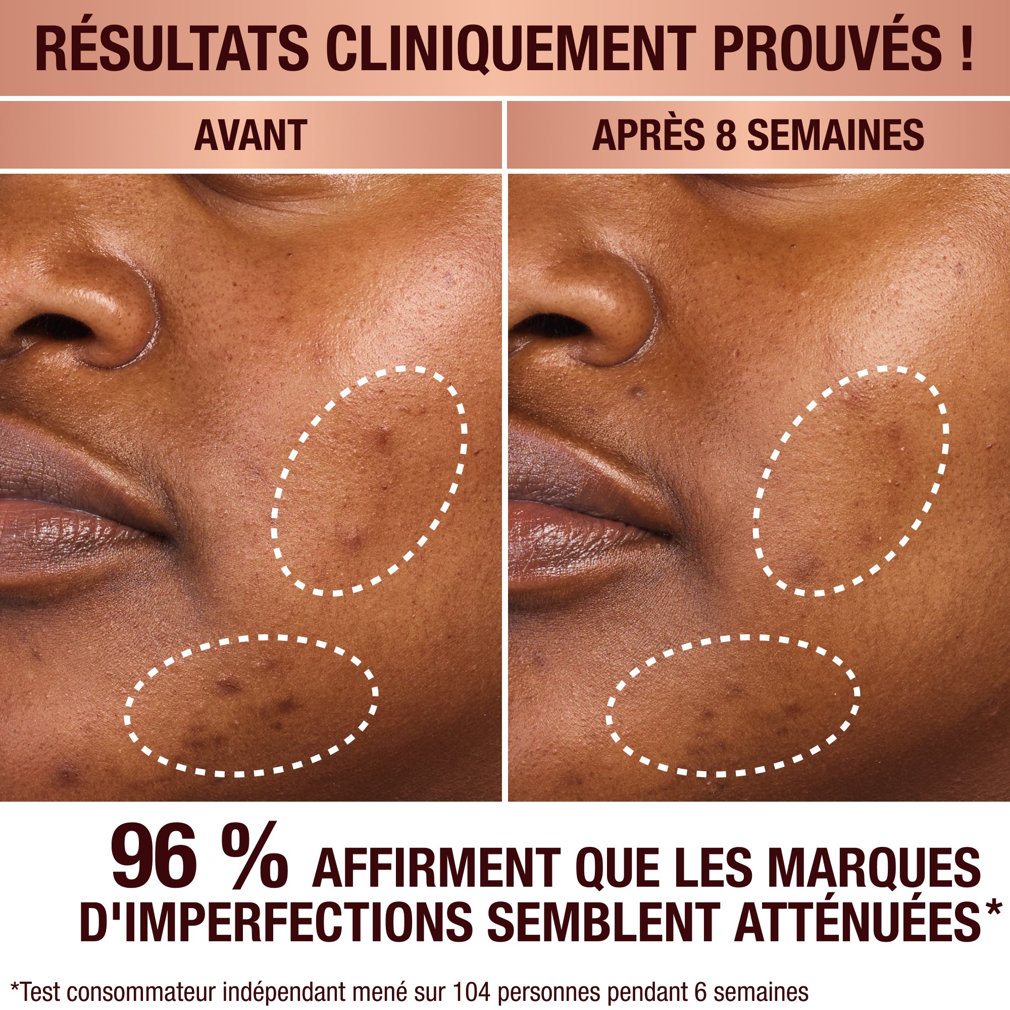 Sérum anti-taches de Charlotte