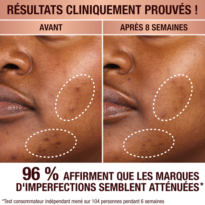 Sérum anti-taches de Charlotte Sérum anti-taches de Charlotte