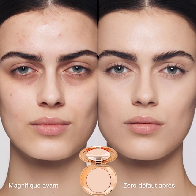 FRCA-MagicVanish Petra BeforeAfter 1000x1000 FRCA-MagicVanish Petra BeforeAfter 1000x1000