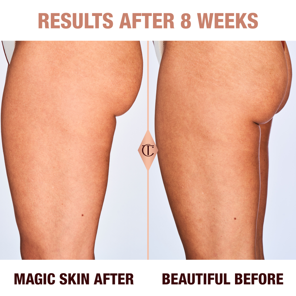 Achieve Your Body Goals With Cellulite Reduction - Charlotte Skin and Laser