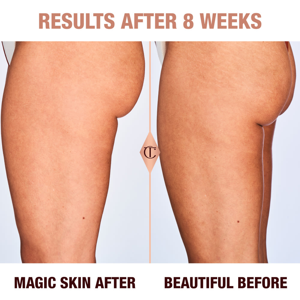 Ariana before and after shot showing Charlotte's Magic Body Cream results after 8 weeks