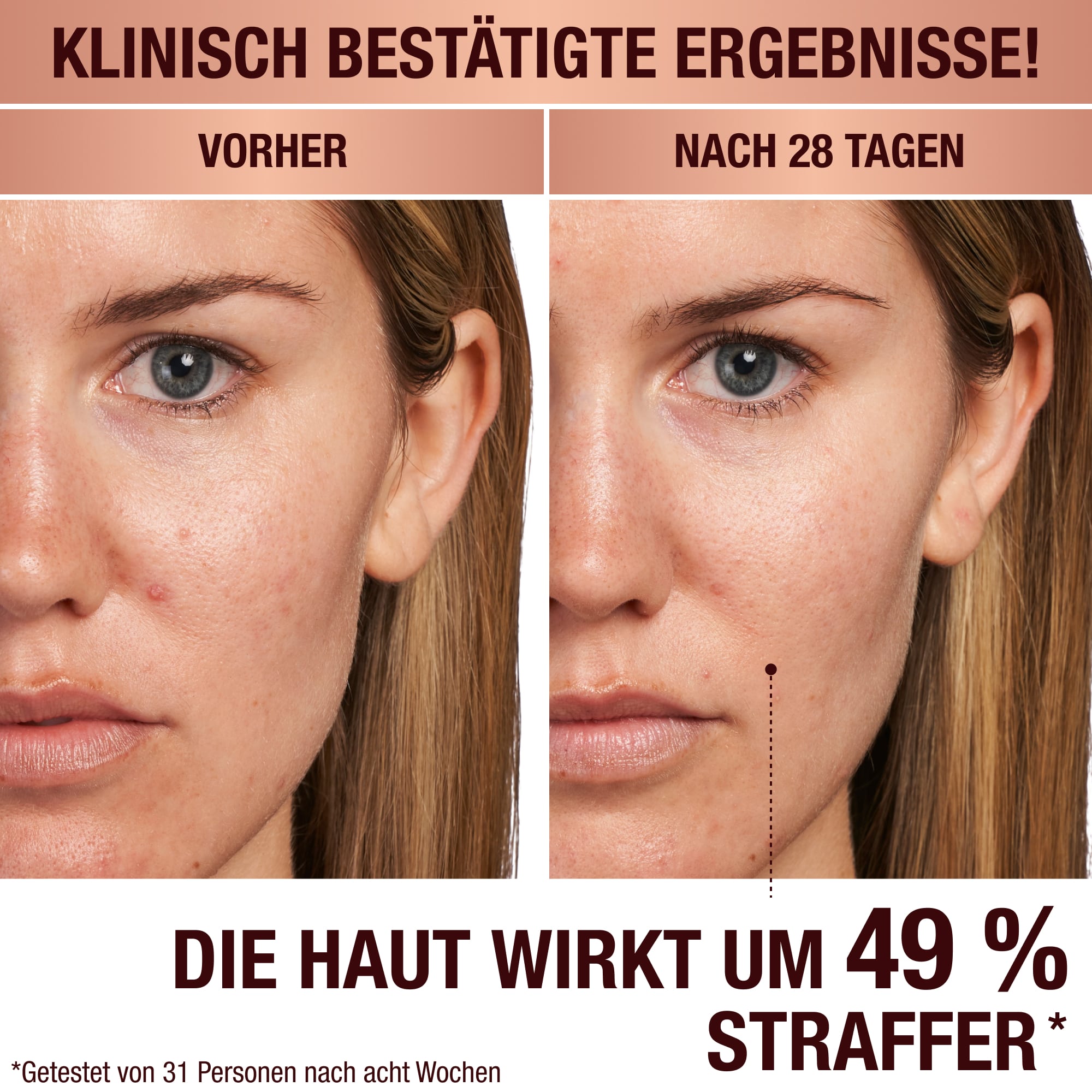 Magic Serum auf einem Model mit hellem Hautton – Vorher-Nachher
