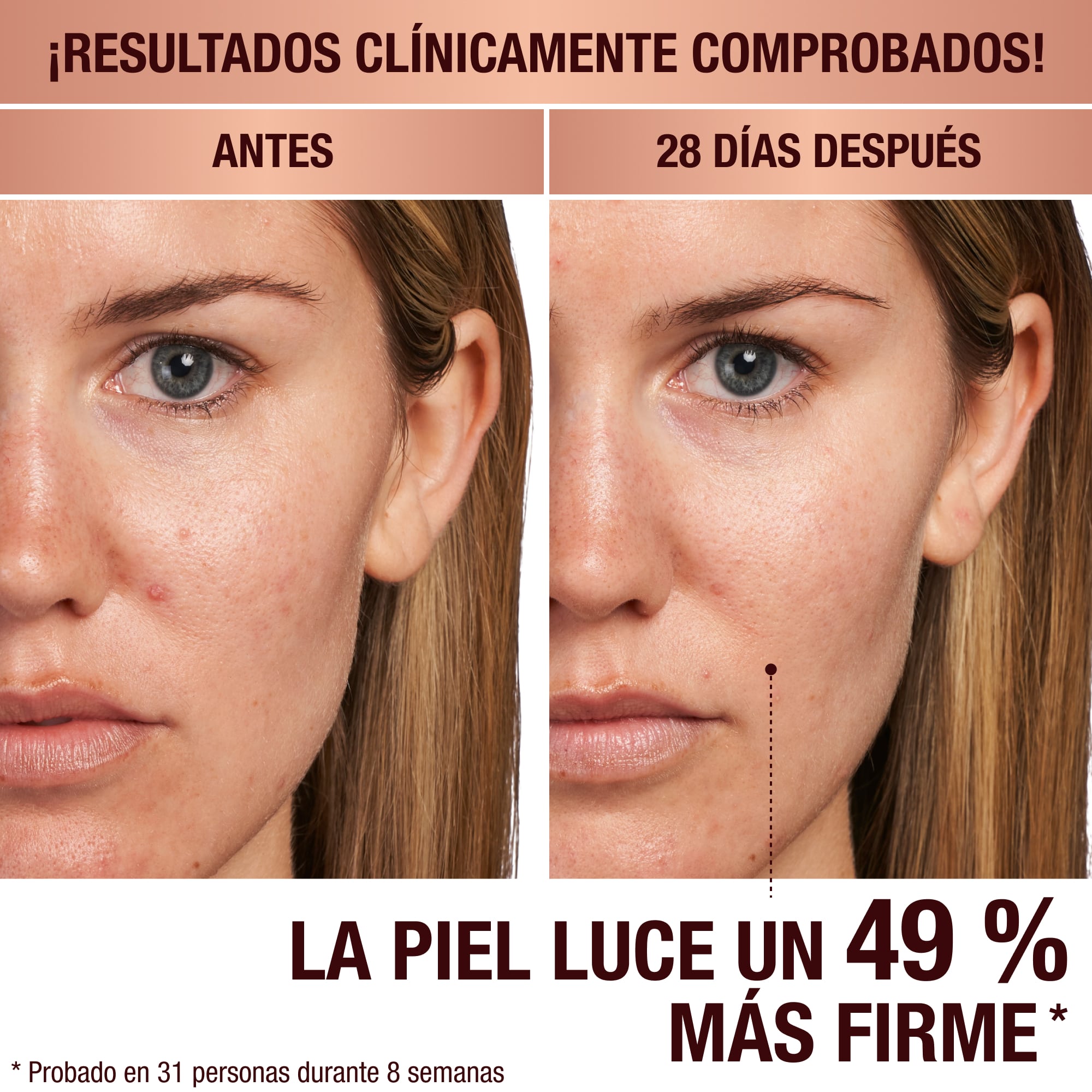 Antes y después de la aplicación del Magic Serum en una modelo de piel clara