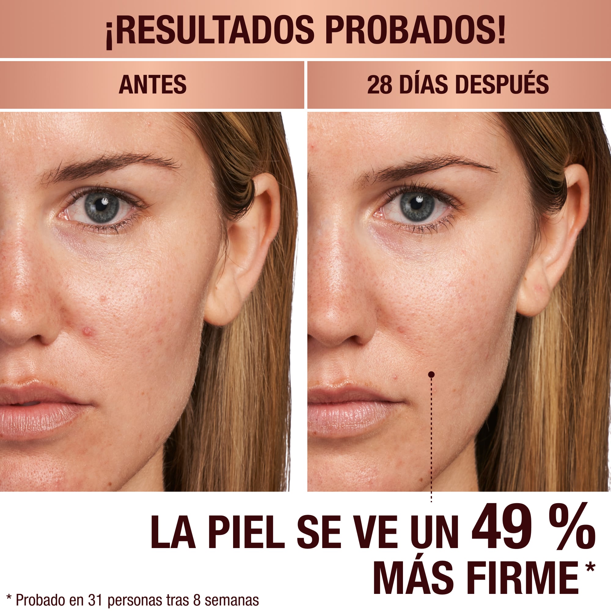 Antes y después de la aplicación del Magic Serum en una modelo con tono de piel claro