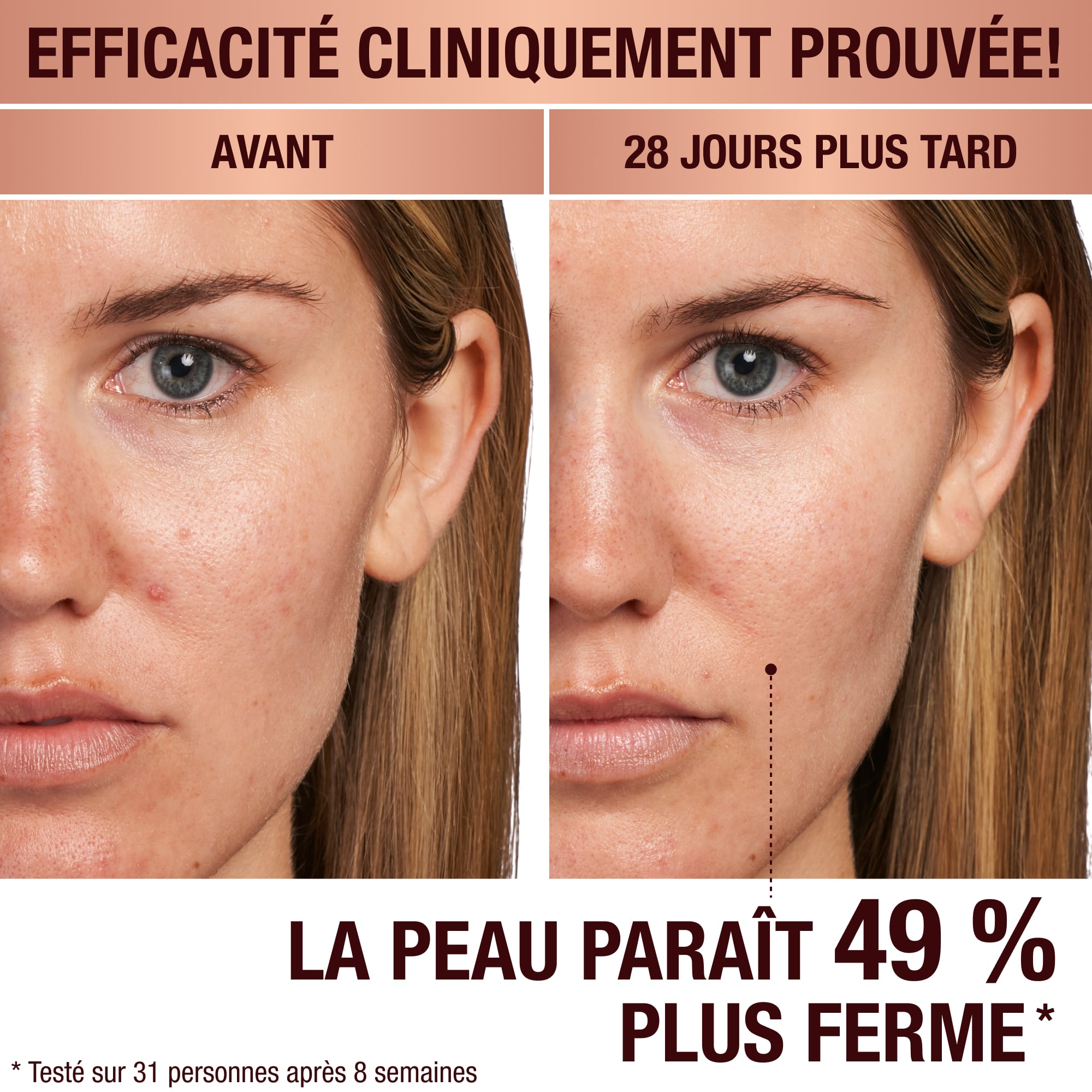 Magic Serum sur un mannequin à la peau claire, avant et après