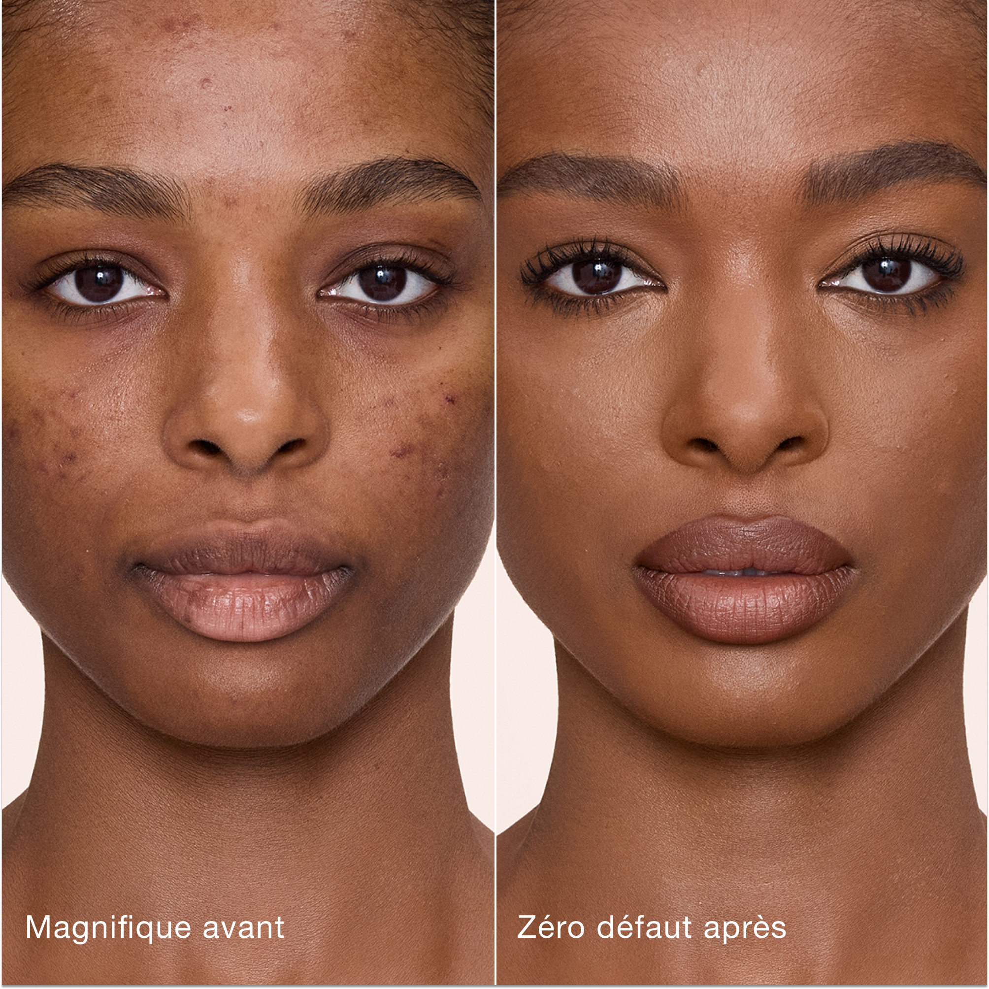 Comparaison côte à côte montrant la peau avant et après l'application de l'Airbrush Flawless Concealer de Charlotte Tilbury, avec les étiquettes de texte « Magnifique avant » et « Zéro défaut après ».
