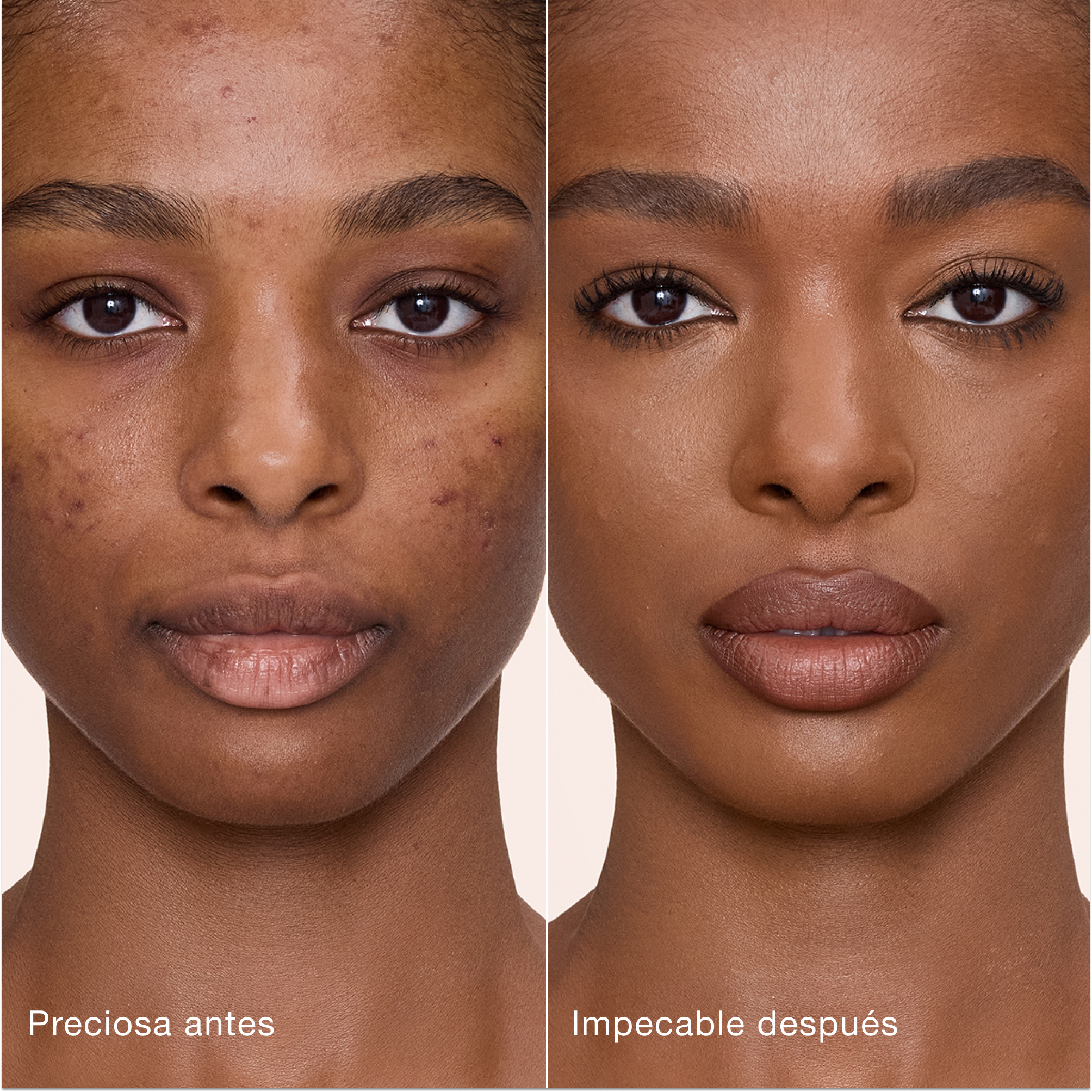 Comparación paralela que muestra la piel antes y después de aplicar el corrector Charlotte Tilbury Airbrush Flawless Concealer con las etiquetas de texto «Preciosa antes» y «Perfecta después».
